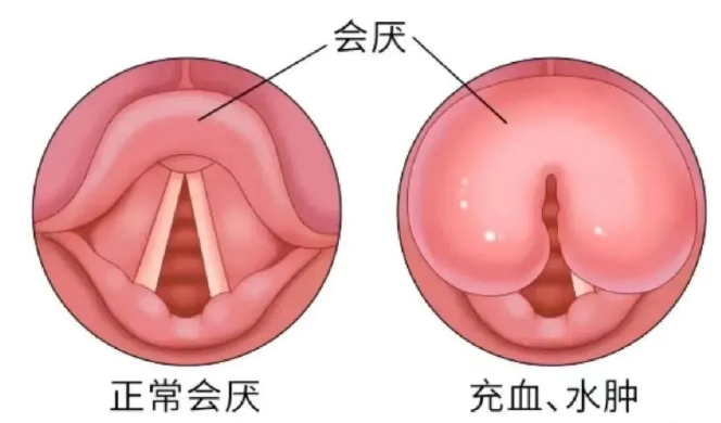 640 (5).png